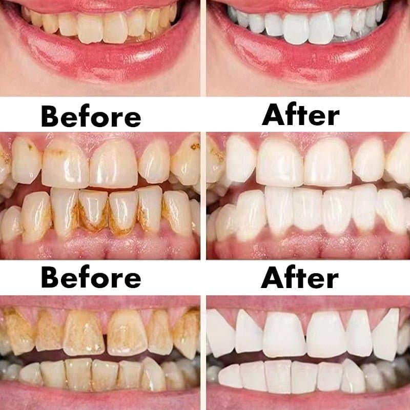 Ceoerty Gum Shield Therapy Gel™ — product detail 1