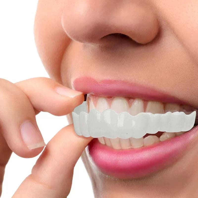 NewSmile - Snap-On Dentures™