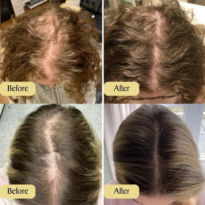 Bobbasow  Natural Hair Growth Oil™