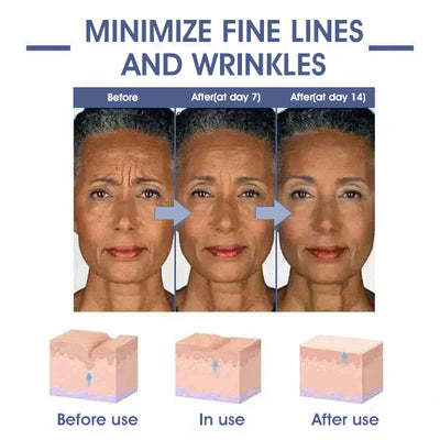𝐋𝐚𝐬𝐭 𝐃𝐚𝐲 𝐃𝐢𝐬𝐜𝐨𝐮𝐧𝐭 87 𝐎𝐅𝐅LOVILDS 𝐀𝐝𝐯𝐚𝐧𝐜𝐞𝐝 𝐅𝐢𝐫𝐦𝐢𝐧𝐠  𝐖𝐫𝐢𝐧𝐤𝐥𝐞-𝐑𝐞𝐝𝐮𝐜𝐢𝐧𝐠 𝐂𝐫𝐞𝐚𝐦 Restore Skin Elasticity™