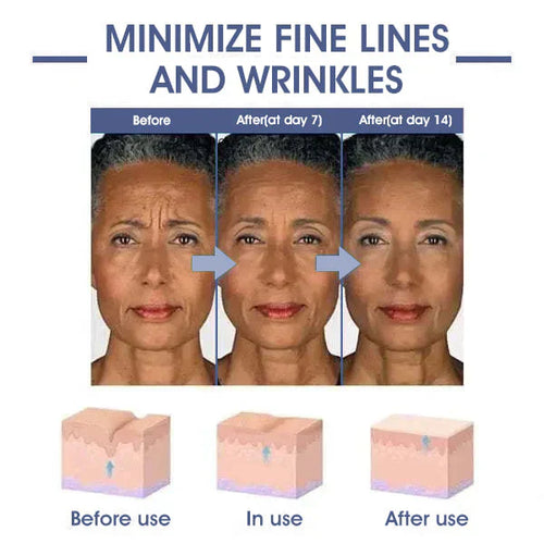 𝐋𝐚𝐬𝐭 𝐃𝐚𝐲 𝐃𝐢𝐬𝐜𝐨𝐮𝐧𝐭 87 𝐎𝐅𝐅LOVILDS 𝐀𝐝𝐯𝐚𝐧𝐜𝐞𝐝 𝐅𝐢𝐫𝐦𝐢𝐧𝐠  𝐖𝐫𝐢𝐧𝐤𝐥𝐞-𝐑𝐞𝐝𝐮𝐜𝐢𝐧𝐠 𝐂𝐫𝐞𝐚𝐦 Restore Skin Elasticity™