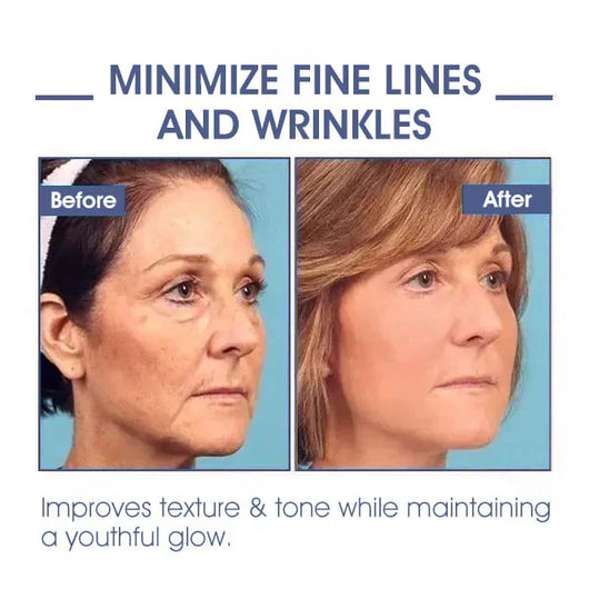 𝐋𝐚𝐬𝐭 𝐃𝐚𝐲 𝐃𝐢𝐬𝐜𝐨𝐮𝐧𝐭 87 𝐎𝐅𝐅LOVILDS 𝐀𝐝𝐯𝐚𝐧𝐜𝐞𝐝 𝐅𝐢𝐫𝐦𝐢𝐧𝐠  𝐖𝐫𝐢𝐧𝐤𝐥𝐞-𝐑𝐞𝐝𝐮𝐜𝐢𝐧𝐠 𝐂𝐫𝐞𝐚𝐦 Restore Skin Elasticity™