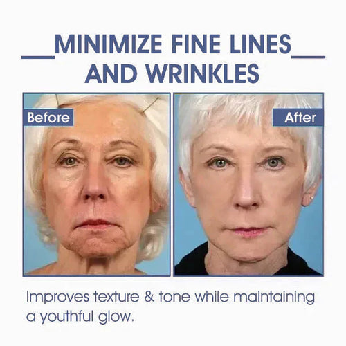 𝐋𝐚𝐬𝐭 𝐃𝐚𝐲 𝐃𝐢𝐬𝐜𝐨𝐮𝐧𝐭 87 𝐎𝐅𝐅LOVILDS 𝐀𝐝𝐯𝐚𝐧𝐜𝐞𝐝 𝐅𝐢𝐫𝐦𝐢𝐧𝐠  𝐖𝐫𝐢𝐧𝐤𝐥𝐞-𝐑𝐞𝐝𝐮𝐜𝐢𝐧𝐠 𝐂𝐫𝐞𝐚𝐦 Restore Skin Elasticity™