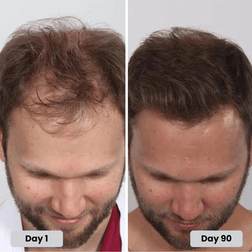 ReviveRoot Hair Growth Cap