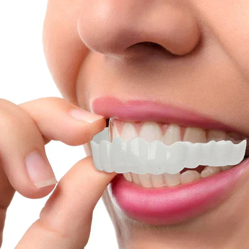 NewSmile - Snap-On Dentures™