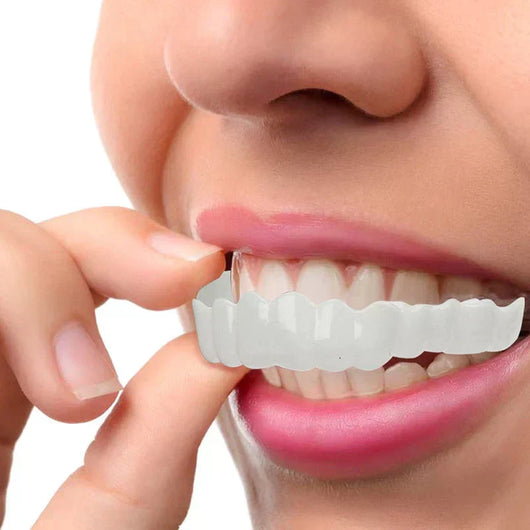 NewSmile - Snap-On Dentures™