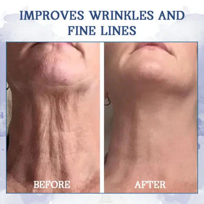 𝐋𝐚𝐬𝐭 𝐃𝐚𝐲 𝐃𝐢𝐬𝐜𝐨𝐮𝐧𝐭 87 𝐎𝐅𝐅LOVILDS 𝐀𝐝𝐯𝐚𝐧𝐜𝐞𝐝 𝐅𝐢𝐫𝐦𝐢𝐧𝐠  𝐖𝐫𝐢𝐧𝐤𝐥𝐞-𝐑𝐞𝐝𝐮𝐜𝐢𝐧𝐠 𝐂𝐫𝐞𝐚𝐦 Restore Skin Elasticity™