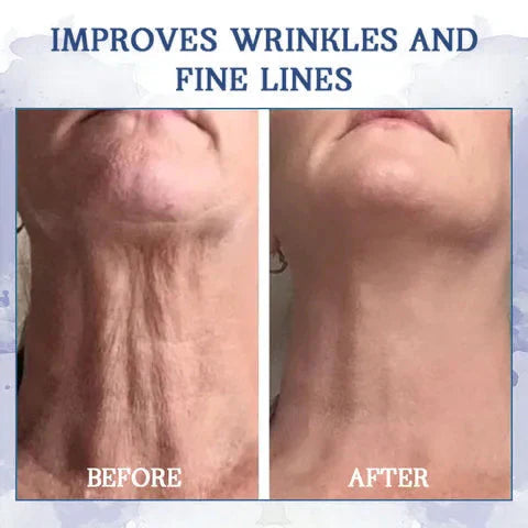 𝐋𝐚𝐬𝐭 𝐃𝐚𝐲 𝐃𝐢𝐬𝐜𝐨𝐮𝐧𝐭 87 𝐎𝐅𝐅LOVILDS 𝐀𝐝𝐯𝐚𝐧𝐜𝐞𝐝 𝐅𝐢𝐫𝐦𝐢𝐧𝐠  𝐖𝐫𝐢𝐧𝐤𝐥𝐞-𝐑𝐞𝐝𝐮𝐜𝐢𝐧𝐠 𝐂𝐫𝐞𝐚𝐦 Restore Skin Elasticity™