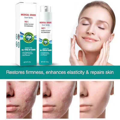 ScarRemove Advanced Scar Spray For All Types of Scars - For example Acne Scars. Surgical Scars and Stretch Marks ™
