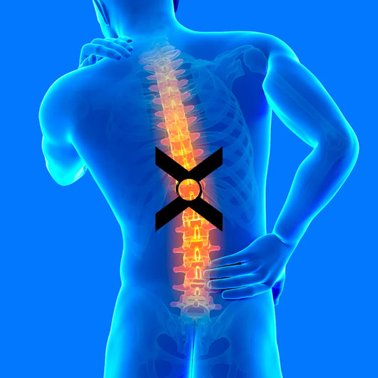 LumbarX Back Belt™