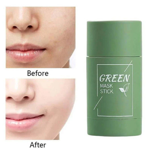 TeaGlow - Deep Cleanse Green Tea Mask™