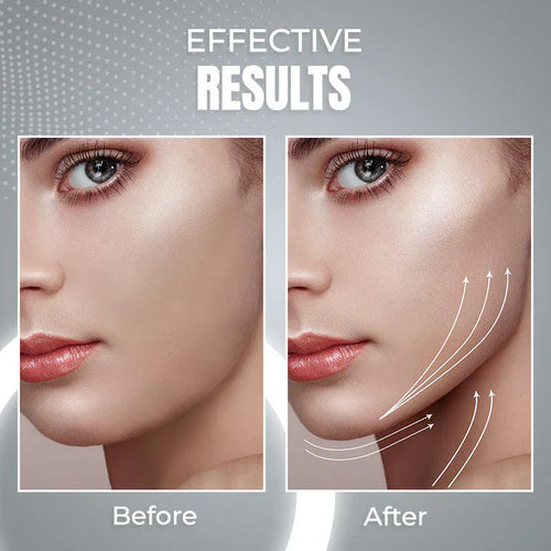 AntiChin - 2 in 1 Anti Snoring and Anti-Aging Facial Contouring Device 50 off™