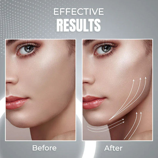 AntiChin - 2 in 1 Anti Snoring and Anti-Aging Facial Contouring Device 50 off™