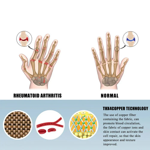 ComfortGrip - Pain Relief Compression Gloves™