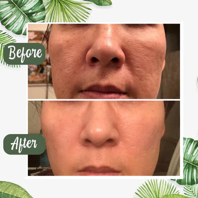 TeaGlow - Deep Cleanse Green Tea Mask™