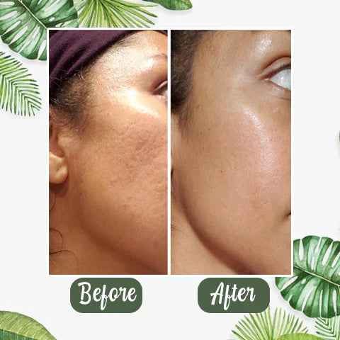 TeaGlow - Deep Cleanse Green Tea Mask™