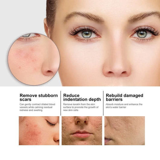 Last Day Promotion 64 OFF-Niacinamide Facial Essence™
