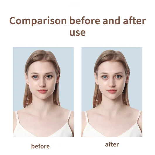 LiftLux - Invisible Face Lift Tape™