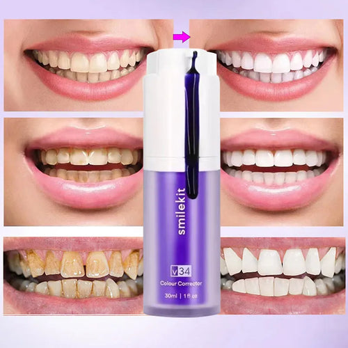 SmileBrite - Teeth Whitening Kit™