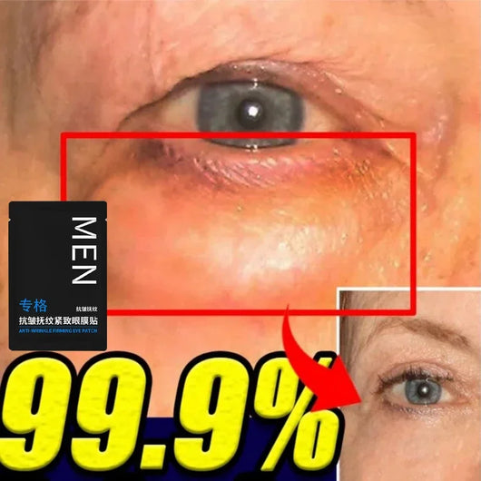 RadiantEyes - Eye Bags Removal Patch™