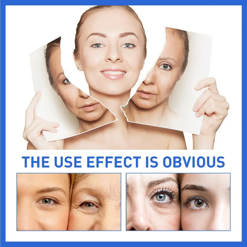 AgeLift - Anti-Age Serum™