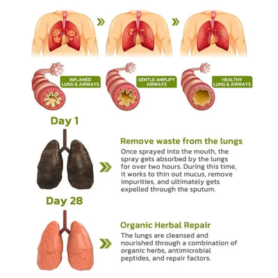 FreshLung - Breath Detox Herbal Lung Cleansing Spray™