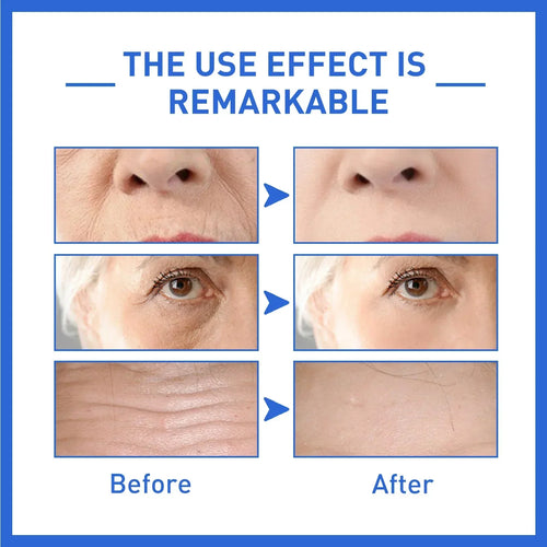 AgeLift - Anti-Age Serum™