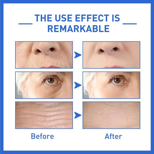 AgeLift - Anti-Age Serum™