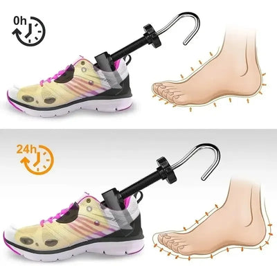 ShoeFit™