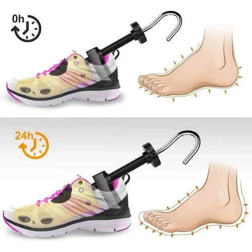 ShoeFit™