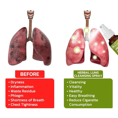 FreshLung - Breath Detox Herbal Lung Cleansing Spray™