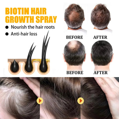 LAST DAY SALE-80 OFF Moonbiffy Biotin Premium Hair Growth Serum™