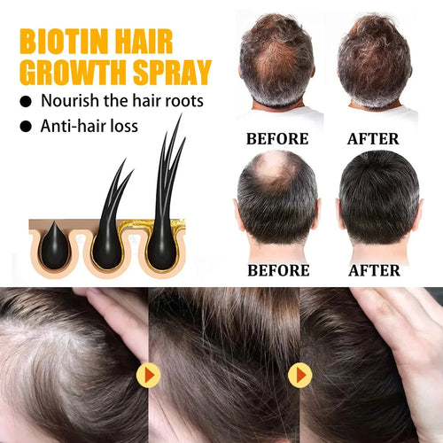 LAST DAY SALE-80 OFF Moonbiffy Biotin Premium Hair Growth Serum™