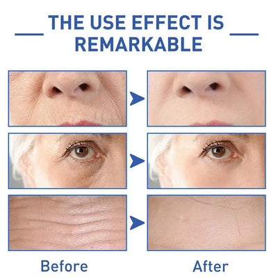 LAST DAY 70 OFFBotox Boost Anti-Aging Serum™