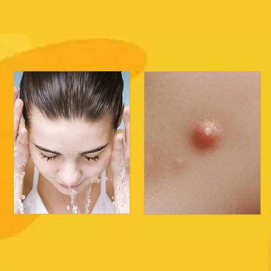 Taganova  TagRecede Bee Venom Treatment Spray™