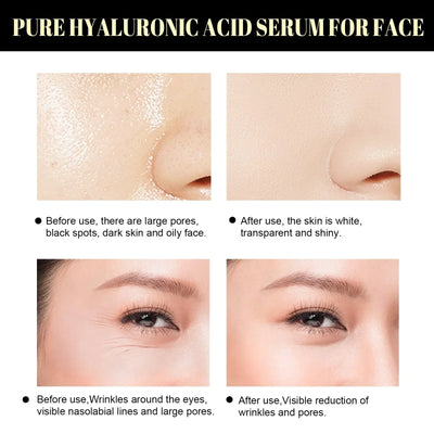 COLLAGEN THREAD WITH 24K GOLD SERUM™