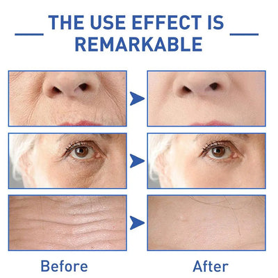 LAST DAY 70 OFFBotox Boost Anti-Aging Serum™