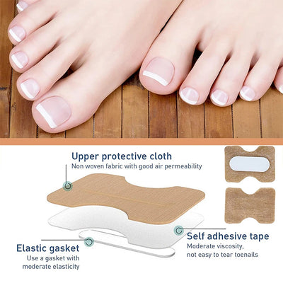 NailFixer™ - Toenail Paronychia Corrector (50 Pcs )