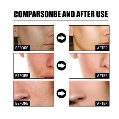 SpotGlow - Niacinamide Facial Essence™