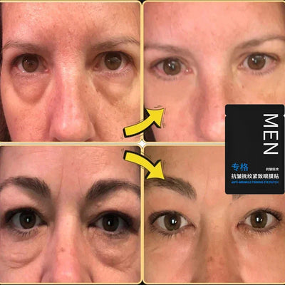 RadiantEyes - Eye Bags Removal Patch™