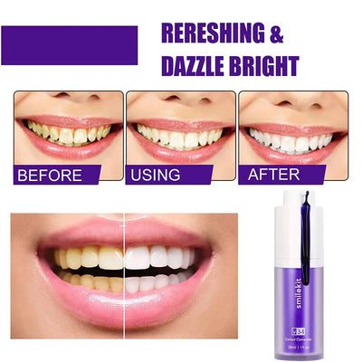 SmileBrite - Teeth Whitening Kit™