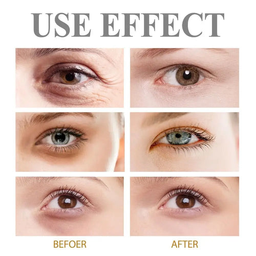 BrightEyes -  Eye Firming Gel™