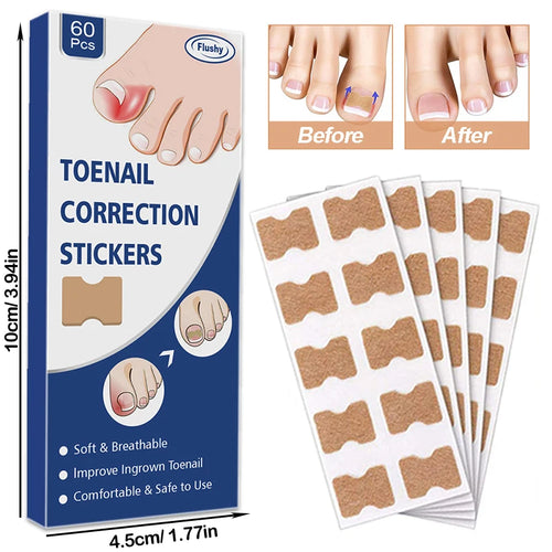 NailFixer™ - Toenail Paronychia Corrector (50 Pcs )