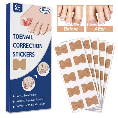 NailFixer™ - Toenail Paronychia Corrector (50 Pcs )