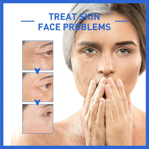 AgeLift - Anti-Age Serum™