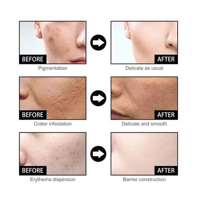 SpotGlow - Niacinamide Facial Essence™