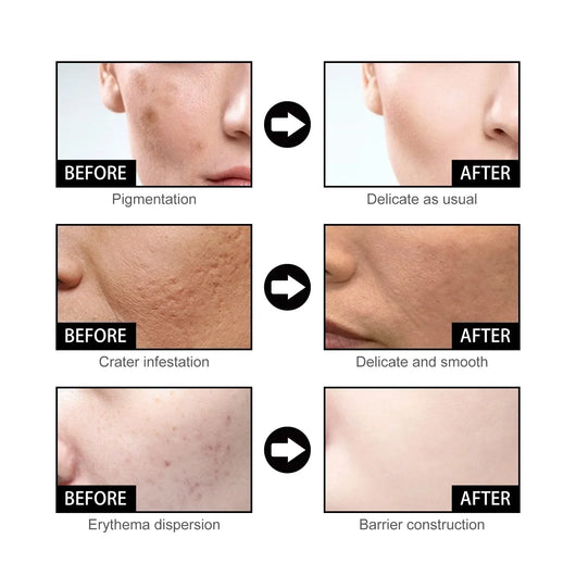 SpotGlow - Niacinamide Facial Essence™