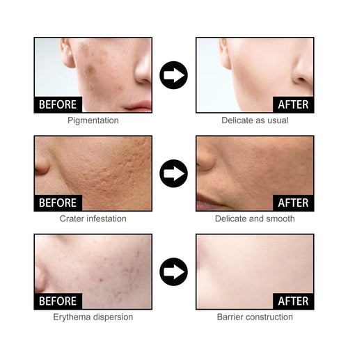 Last Day Promotion 64 OFF-Niacinamide Facial Essence™