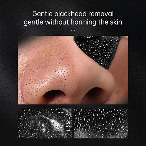 Cleanuest - Blackhead Remover Mask™