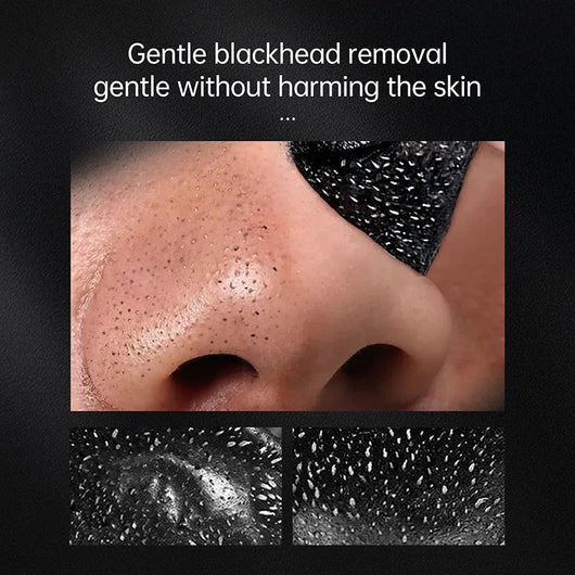 Cleanuest - Blackhead Remover Mask™
